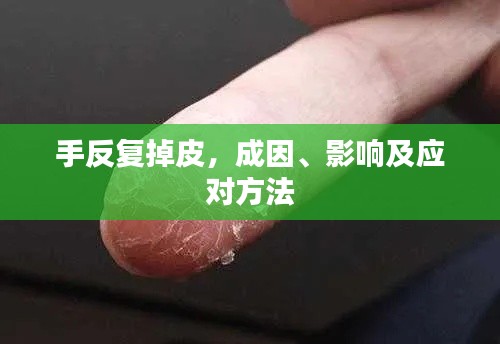 手反复掉皮,成因、影响及应对方法